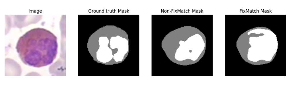 Semi-Supervised Semantic Segmentation using Redesigned Self-Training for White Blood Cells