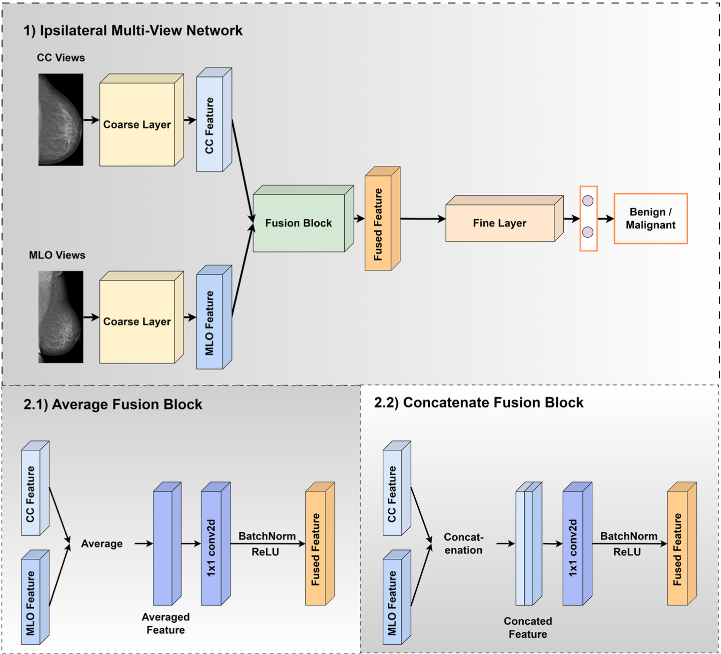 Ipsilateral Mammogram Assessment under Multi-View Network