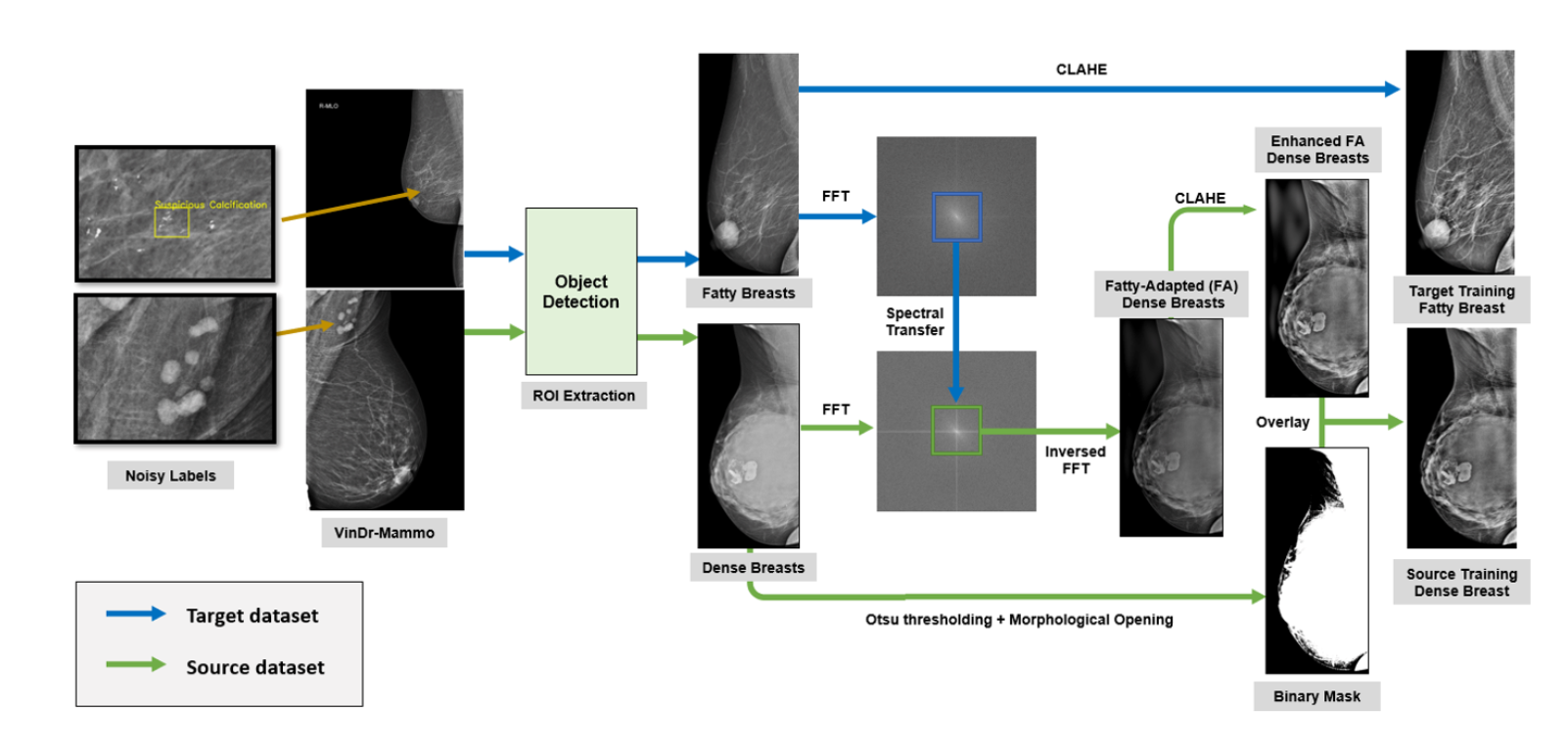 In-context Cross-Density Adaptation on Noisy Mammogram Abnormalities Detection